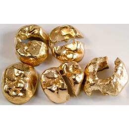 Ankauf Zahngold