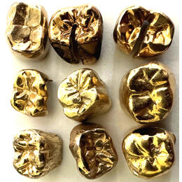 Zahngold Wert pro Gramm