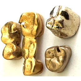 Zahngold Legierung