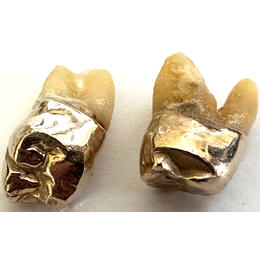 Zahngold Preis