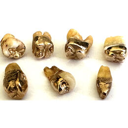 Zahngold Preis