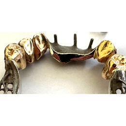 Zahngold Goldkrone Brücke 