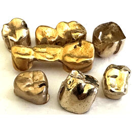 Zahngold Rechner