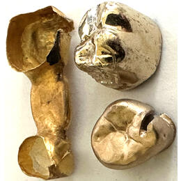 Zahngold Rechner