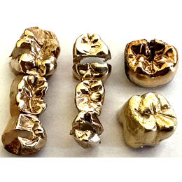 Wieviel ist Zahngold Wert