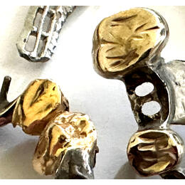 Zahngold mit Zahnspange und Brücke