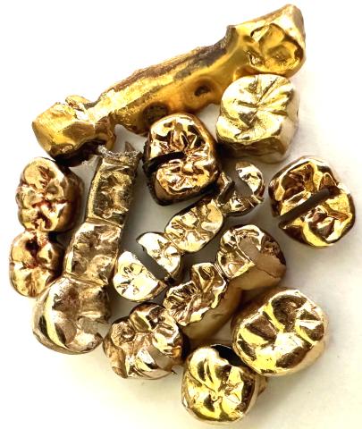 Zahngold Ankauf 