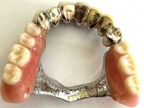 Zahngold vom Zahnarzt