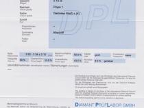 Diamant und Brillant 0,189 Carat mit Zertifikat DPL-TY151